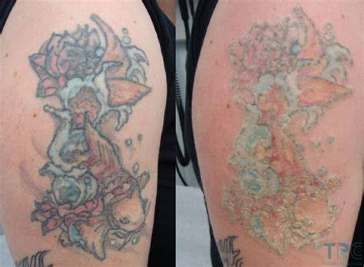 Which colors fade the fastest tattoo?