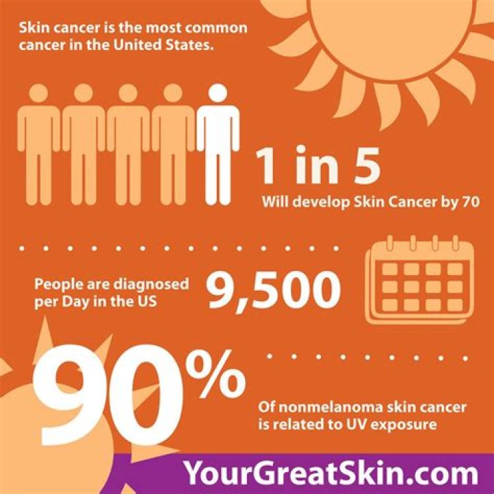 Who is most at risk of melanoma?