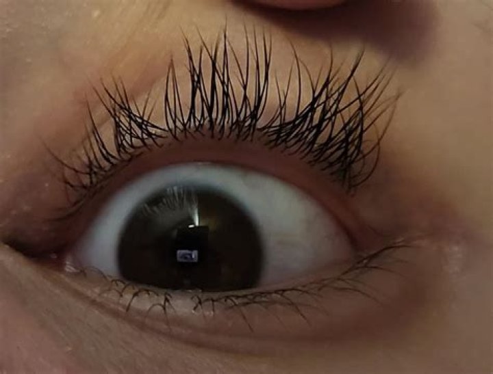 Why do I have 3 rows of eyelashes?