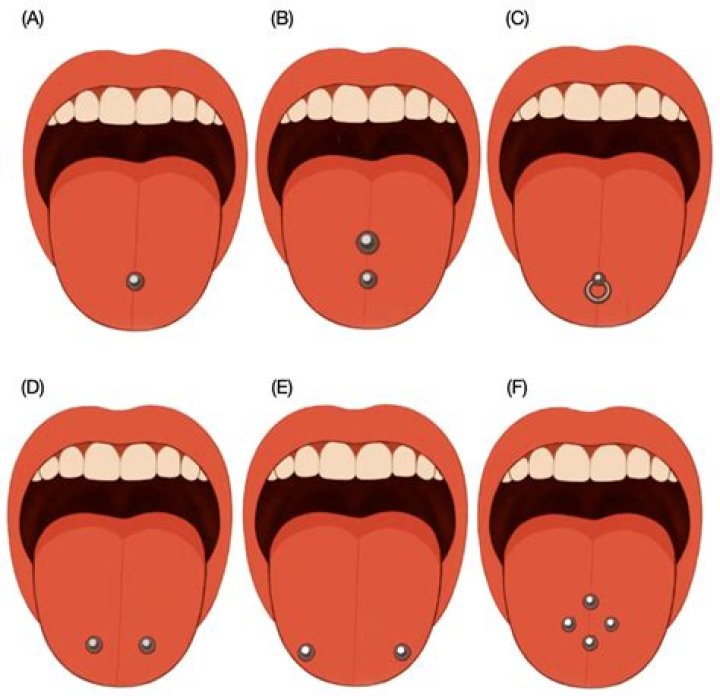 Why is the bottom ball of my tongue piercing white?