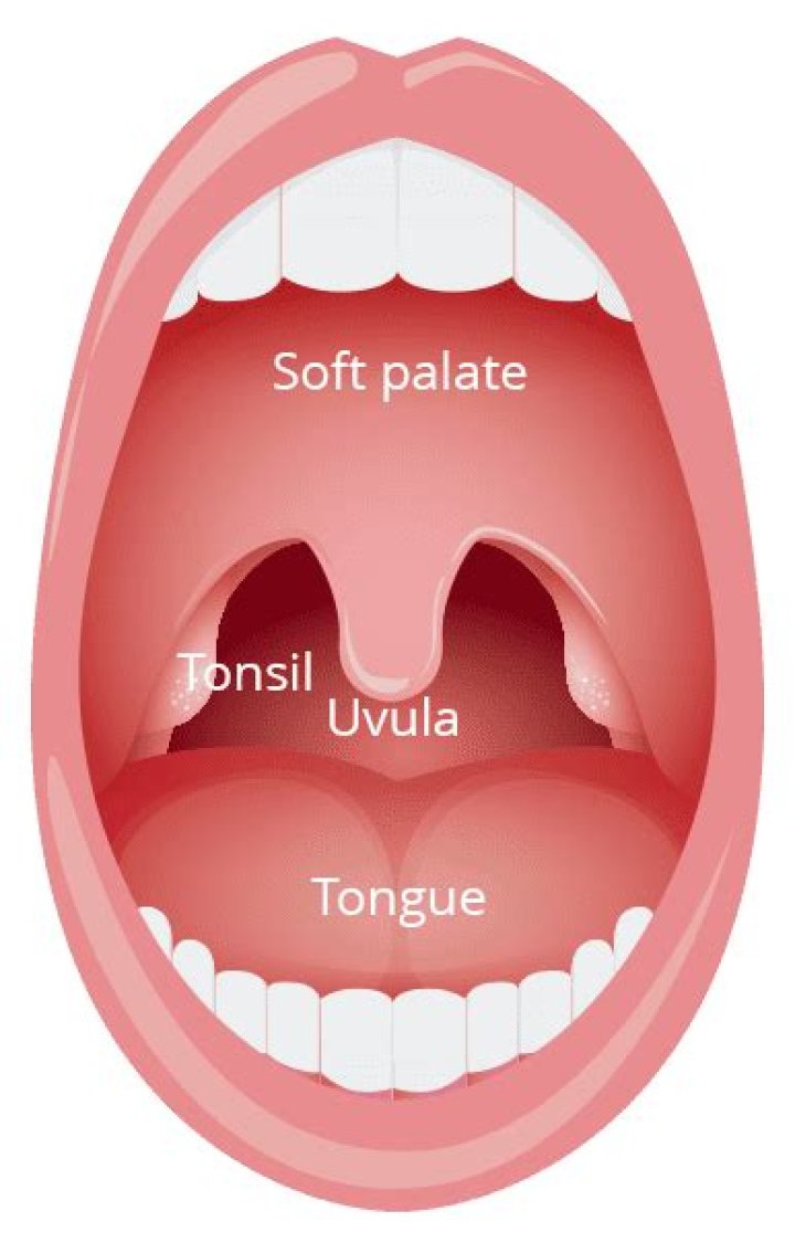 Why is the tip of my uvula white?
